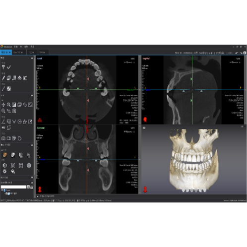 [3D Industrial] Dentiq3D